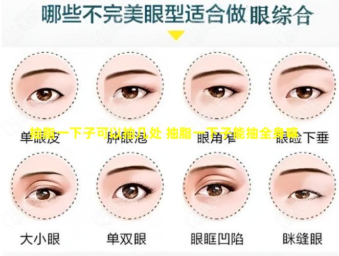 抽脂一下子可以抽几处 抽脂一下子能抽全身嘛